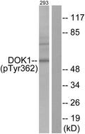Anti-Phospho-DOK1-Tyr362 antibody (329-378 aa) (STJ90244) – Figure 1 of 1