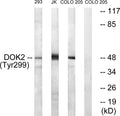 Anti-Phospho-DOK2-Tyr299 antibody (266-315 aa) (STJ90245) – Figure 1 of 1