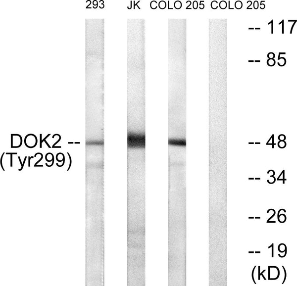 Anti-Phospho-DOK2-Tyr299 antibody (266-315 aa) (STJ90245) – Figure 1 of 1
