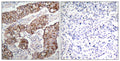 Anti-Phospho-EGFR-Tyr1092 antibody (1061-1110 aa) (STJ90248) – Figure 1 of 1