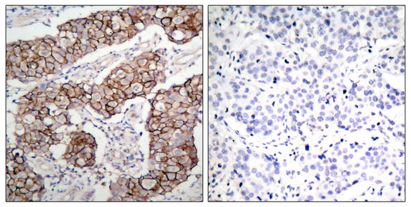 Anti-Phospho-EGFR-Tyr1092 antibody (1061-1110 aa) (STJ90248) – Figure 1 of 1