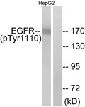 Anti-Phospho-EGFR-Tyr1110 antibody (1077-1126 aa) (STJ90249) – Figure 1 of 1