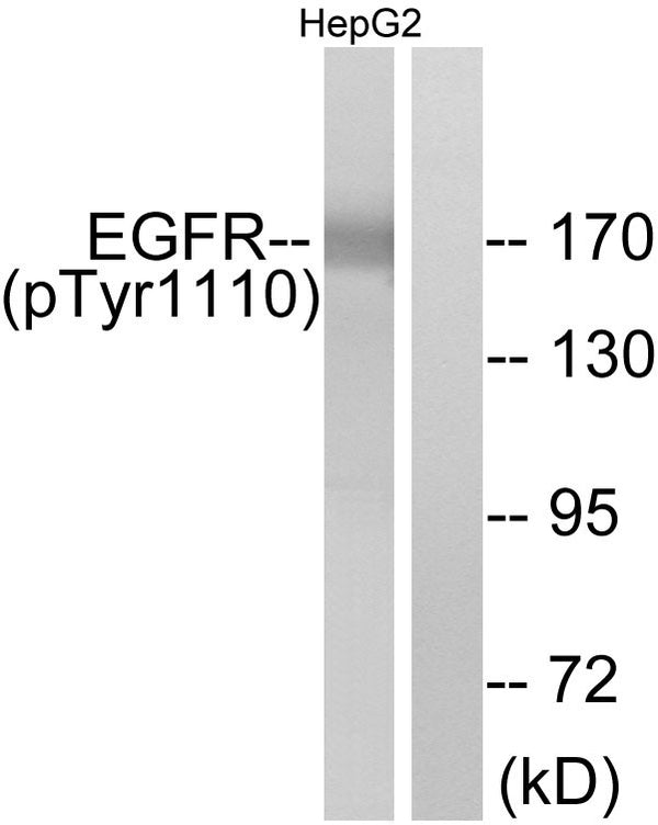Anti-Phospho-EGFR-Tyr1110 antibody (1077-1126 aa) (STJ90249) – Figure 1 of 1
