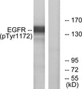 Anti-Phospho-EGFR-Tyr1172 antibody (1139-1188 aa) (STJ90250) – Figure 1 of 1