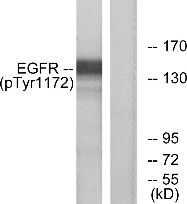 Anti-Phospho-EGFR-Tyr1172 antibody (1139-1188 aa) (STJ90250) – Figure 1 of 1
