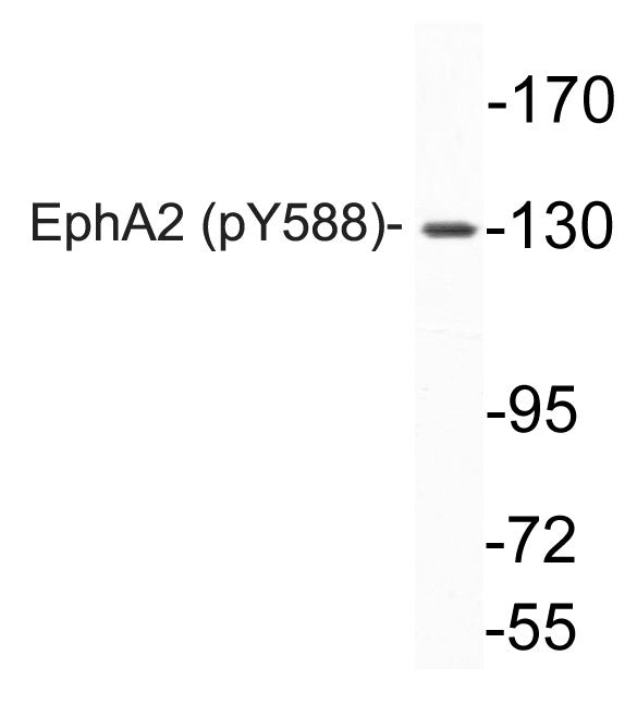 Anti-Phospho-EPHA2-Tyr588 antibody (STJ90258) – Figure 1 of 1