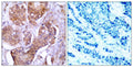 Anti-Phospho-ESR1-Ser106 antibody (71-120 aa) (STJ90263) – Figure 1 of 1