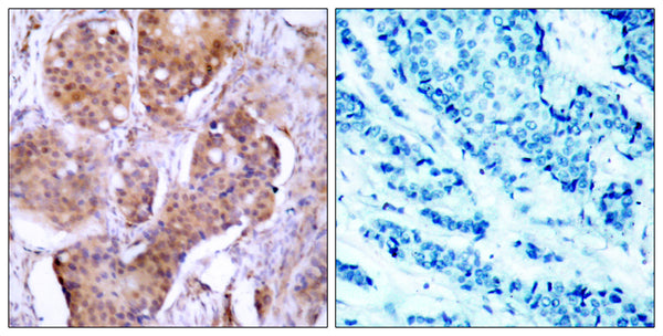 Anti-Phospho-ESR1-Ser106 antibody (71-120 aa) (STJ90263) – Figure 1 of 1
