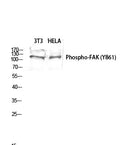 Anti-Phospho-PTK2-Tyr861 antibody (828-877 aa) (STJ90268) – Figure 1 of 1