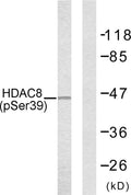Anti-Phospho-HDAC8-Ser39 antibody (5-54 aa) (STJ90287) – Figure 1 of 1
