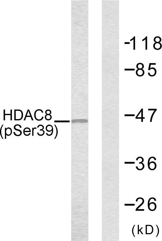 Anti-Phospho-HDAC8-Ser39 antibody (5-54 aa) (STJ90287) – Figure 1 of 1