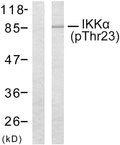 Anti-Phospho-CHUK-Thr23 antibody (15-64 aa) (STJ90300) – Figure 1 of 1