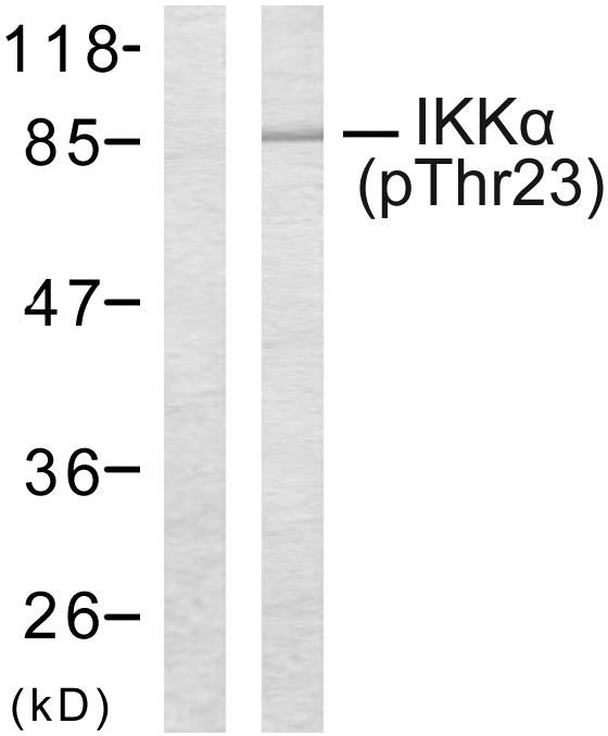 Anti-Phospho-CHUK-Thr23 antibody (15-64 aa) (STJ90300) – Figure 1 of 1
