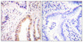 Anti-Phospho-MEF2D-Ser444 antibody (410-459 aa) (STJ90325) – Figure 1 of 1