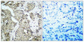 Anti-Phospho-MAP2K3-Ser218 antibody (173-222 aa) (STJ90330) – Figure 1 of 1