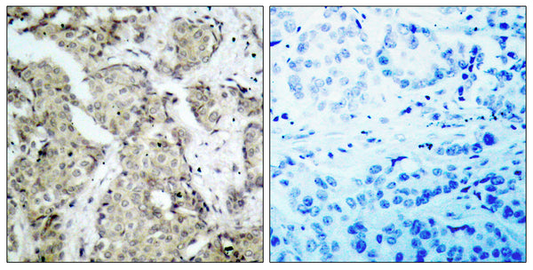 Anti-Phospho-MAP2K3-Ser218 antibody (173-222 aa) (STJ90330) – Figure 1 of 1