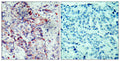 Anti-Phospho-MAP2K4-Ser80 antibody (46-95 aa) (STJ90331) – Figure 1 of 1