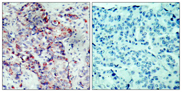 Anti-Phospho-MAP2K4-Ser80 antibody (46-95 aa) (STJ90331) – Figure 1 of 1