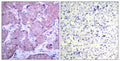 Anti-Phospho-PTEN-Ser380 antibody (366-395 aa) (STJ90398) – Figure 1 of 1