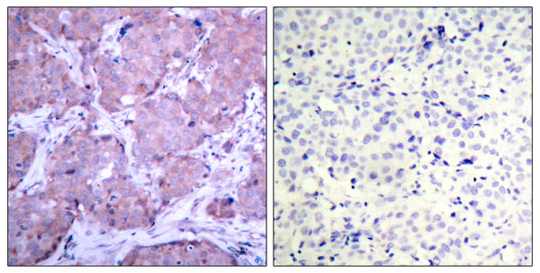 Anti-Phospho-PTEN-Ser380 antibody (366-395 aa) (STJ90398) – Figure 1 of 1