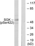 Anti-Phospho-SGK1-Ser422 antibody (381-430 aa) (STJ90404) – Figure 1 of 1