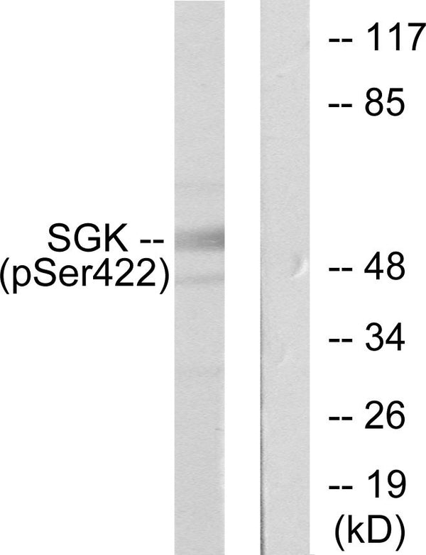 Anti-Phospho-SGK1-Ser422 antibody (381-430 aa) (STJ90404) – Figure 1 of 1