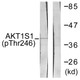Anti-Phospho-AKT1S1-Thr246 antibody (207-256 aa) (STJ90462) – Figure 1 of 1