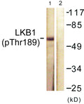 Anti-Phospho-STK11-Thr189 antibody (155-204 aa) (STJ90488) – Figure 1 of 1