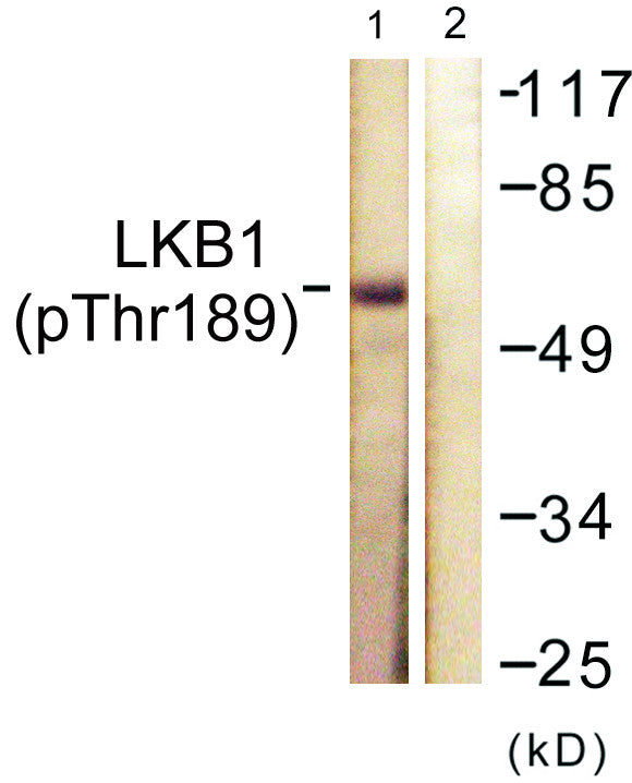 Anti-Phospho-STK11-Thr189 antibody (155-204 aa) (STJ90488) – Figure 1 of 1