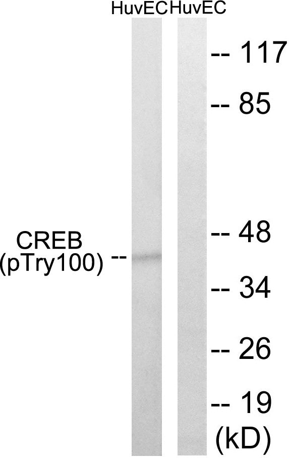 Anti-Phospho-CREB1-Thr100 antibody (71-120 aa) (STJ90565) – Figure 1 of 1