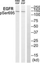 Anti-Phospho-EGFR-Ser695 antibody (661-710 aa) (STJ90566) – Figure 1 of 1