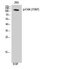 Anti-Phospho-PTK2-Tyr397 antibody (364-413 aa) (STJ90675) – Figure 1 of 1