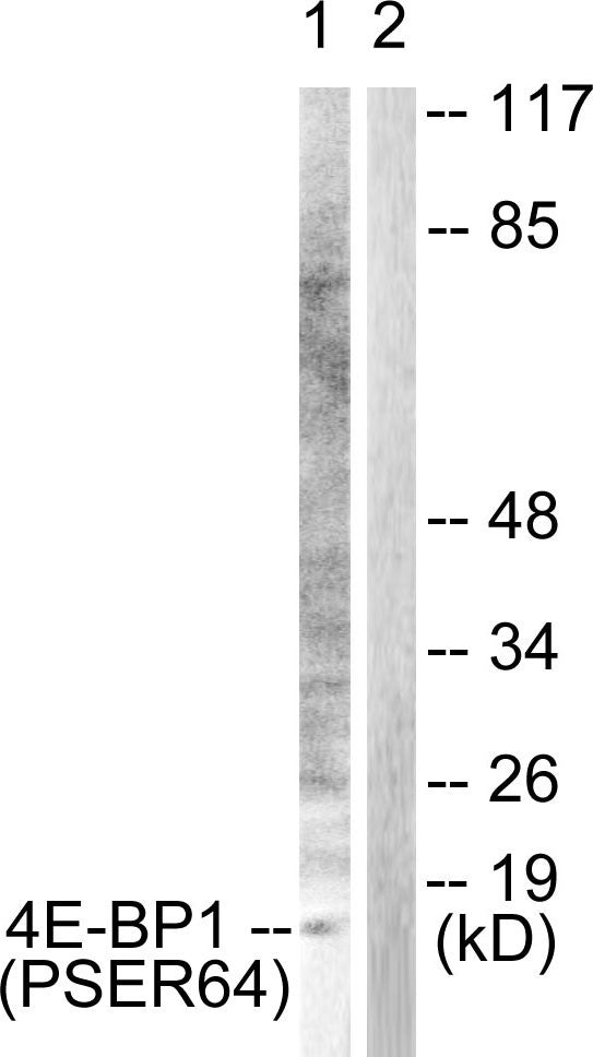 Anti-Phospho-EIF4EBP1-Ser65 antibody (30-79 aa) (STJ90778) – Figure 1 of 1