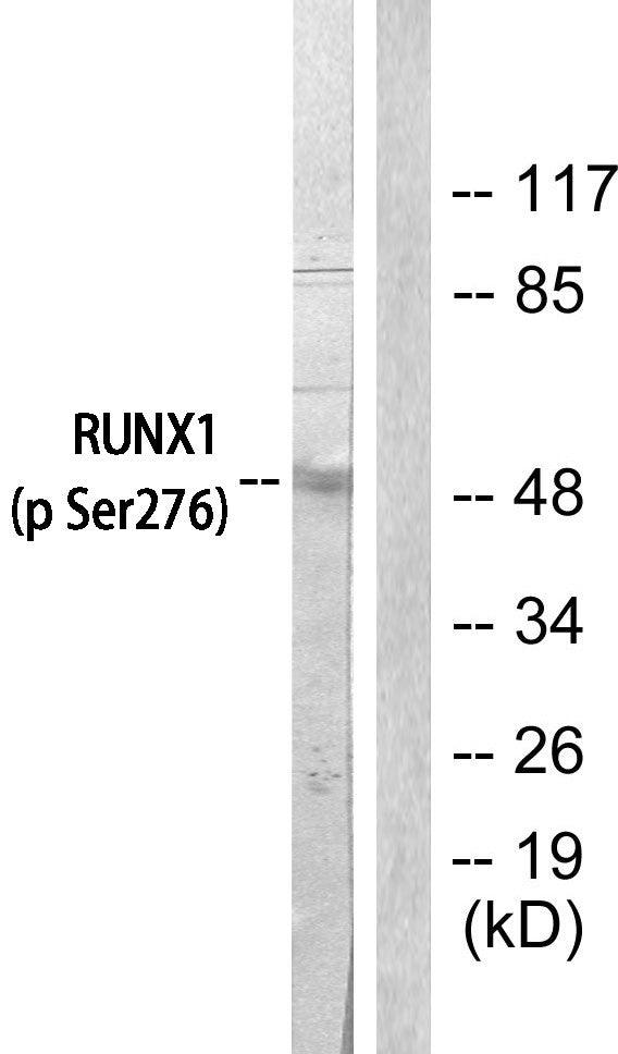 Anti-Phospho-RUNX1-Ser276 antibody (269-318 aa) (STJ90782) – Figure 1 of 1