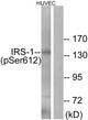 Anti-Phospho-IRS1-Ser616 antibody (578-627 aa) (STJ90800) – Figure 1 of 1