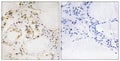 Anti-Phospho-BCL2-Ser87 antibody (61-110 aa) (STJ90806) – Figure 1 of 1