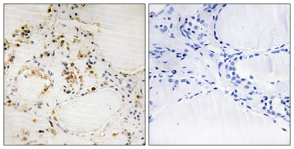 Anti-Phospho-BCL2-Ser87 antibody (61-110 aa) (STJ90806) – Figure 1 of 1