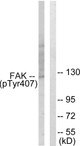 Anti-Phospho-PTK2-Tyr407 antibody (373-422 aa) (STJ90809) – Figure 1 of 1