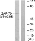 Anti-Phospho-ZAP70-Tyr315 antibody (281-330 aa) (STJ90842) – Figure 1 of 1