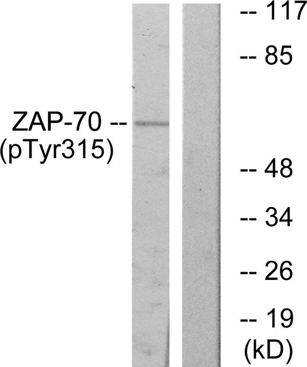 Anti-Phospho-ZAP70-Tyr315 antibody (281-330 aa) (STJ90842) – Figure 1 of 1