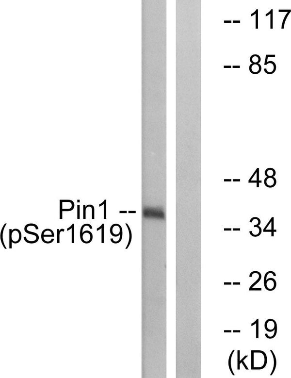 Anti-Phospho-PIN1-Ser16 antibody (1-50 aa) (STJ90862) – Figure 1 of 1