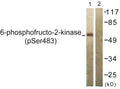 Anti-Phospho-PFKFB2-Ser483 antibody (451-500 aa) (STJ90871) – Figure 1 of 1