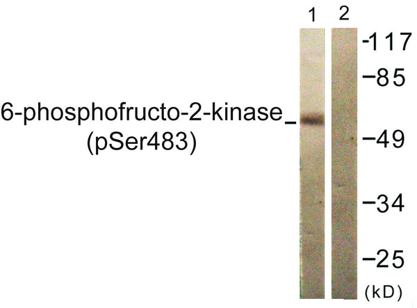 Anti-Phospho-PFKFB2-Ser483 antibody (451-500 aa) (STJ90871) – Figure 1 of 1