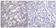 Anti-Phospho-BRAF-Ser602 antibody (576-625 aa) (STJ90876) – Figure 1 of 1