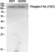 Anti-Phospho-PTK2-Tyr397 antibody (363-412 aa) (STJ90899) – Figure 1 of 1