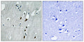 Anti-Phospho-PDCD4-Ser457 antibody (420-469 aa) (STJ90921) – Figure 1 of 1