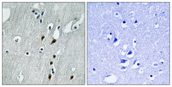 Anti-Phospho-PDCD4-Ser457 antibody (420-469 aa) (STJ90921) – Figure 1 of 1