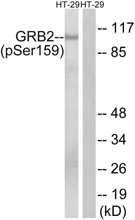 Anti-Phospho-GAB2-Ser159 antibody (125-174 aa) (STJ90967) – Figure 1 of 1