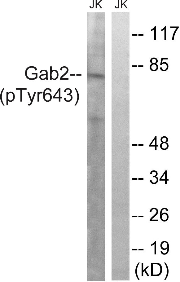 Anti-Phospho-GAB2-Tyr643 antibody (609-658 aa) (STJ90977) – Figure 1 of 1