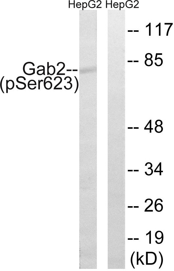 Anti-Phospho-GAB2-Ser623 antibody (589-638 aa) (STJ90978) – Figure 1 of 1